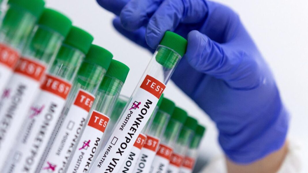 Mumbai Strengthens Mpox Measures Amid Global Scare