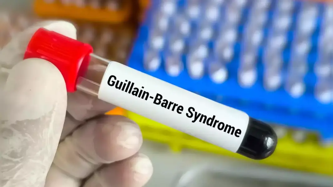 Mumbai Reports Guillain-Barré Syndrome in Woman